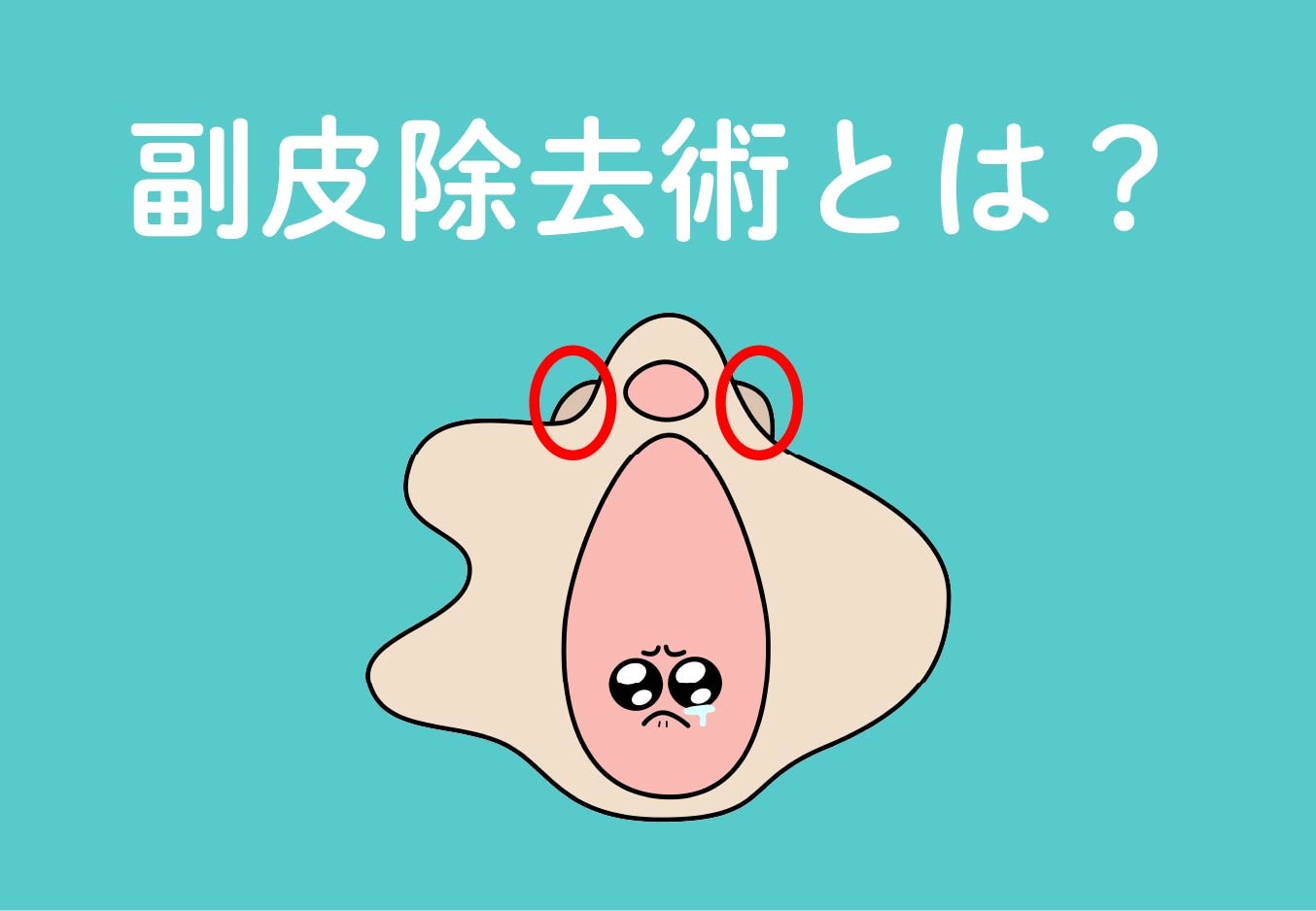 副皮除去術