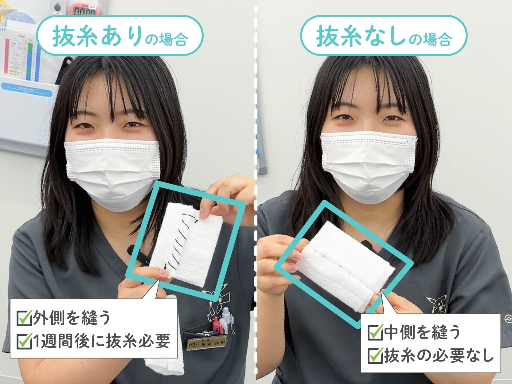 婦人科形成術の【抜糸あり】と【抜糸なし】の違いについて