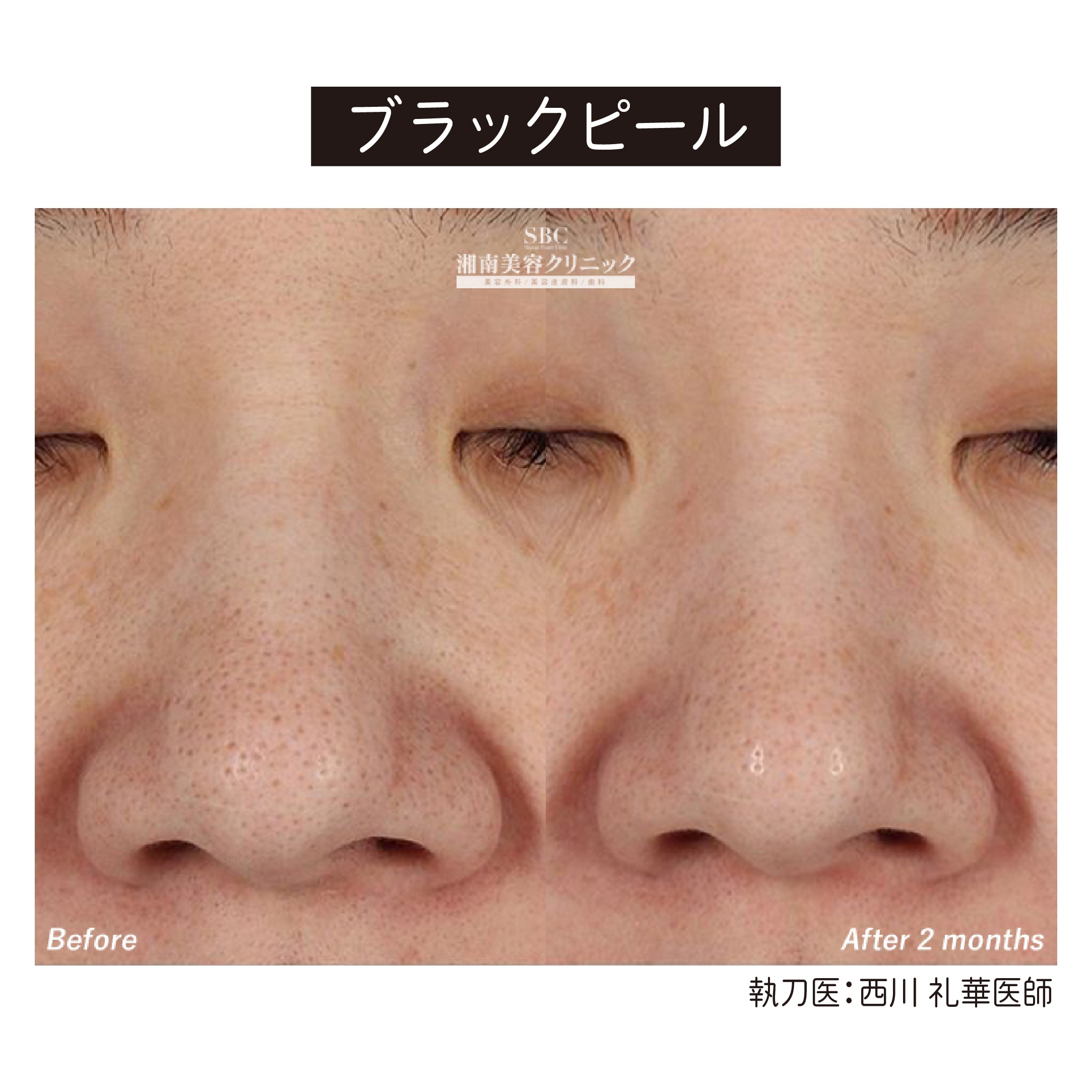 美肌治療の症例について