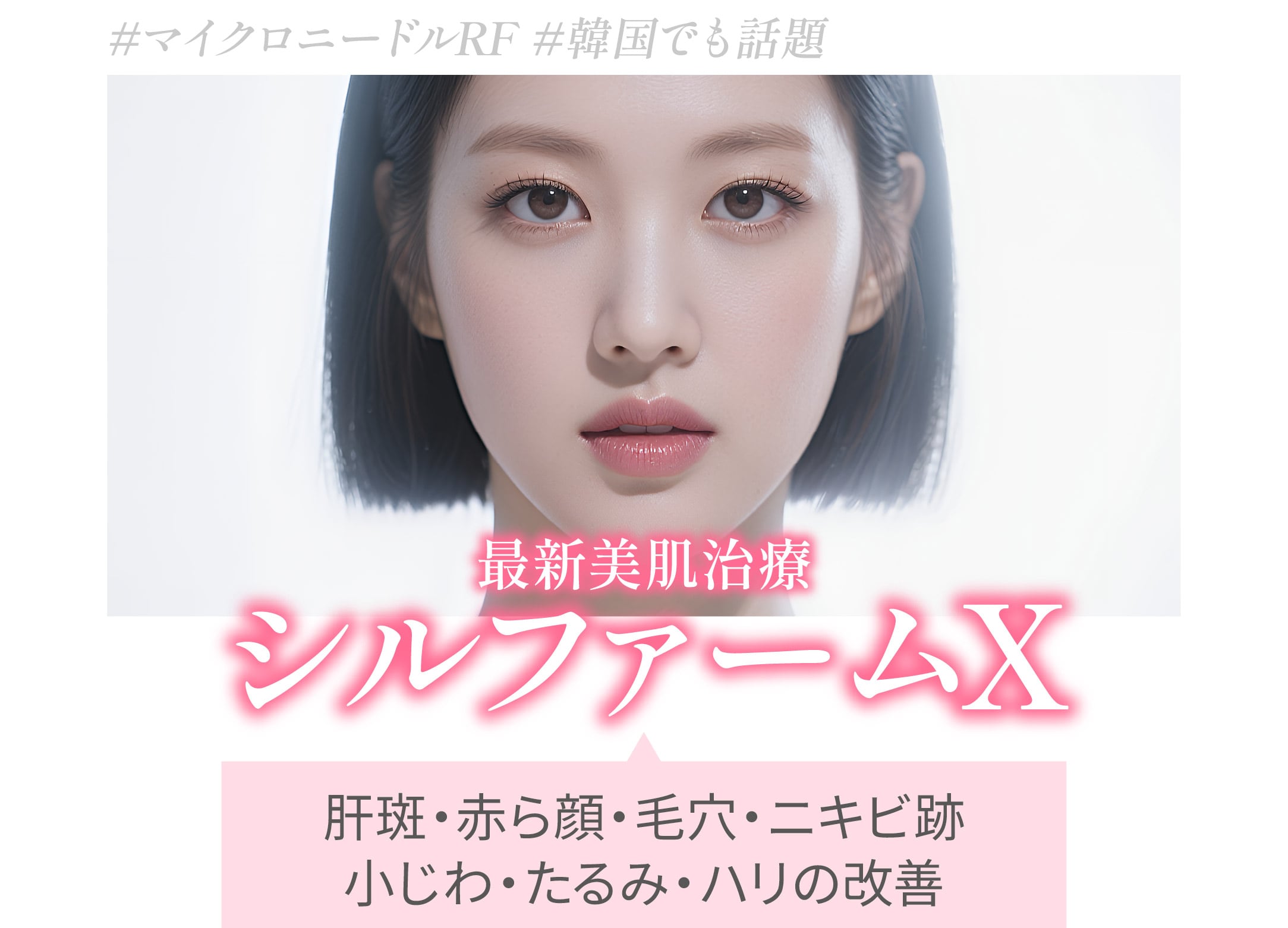 シルファームX