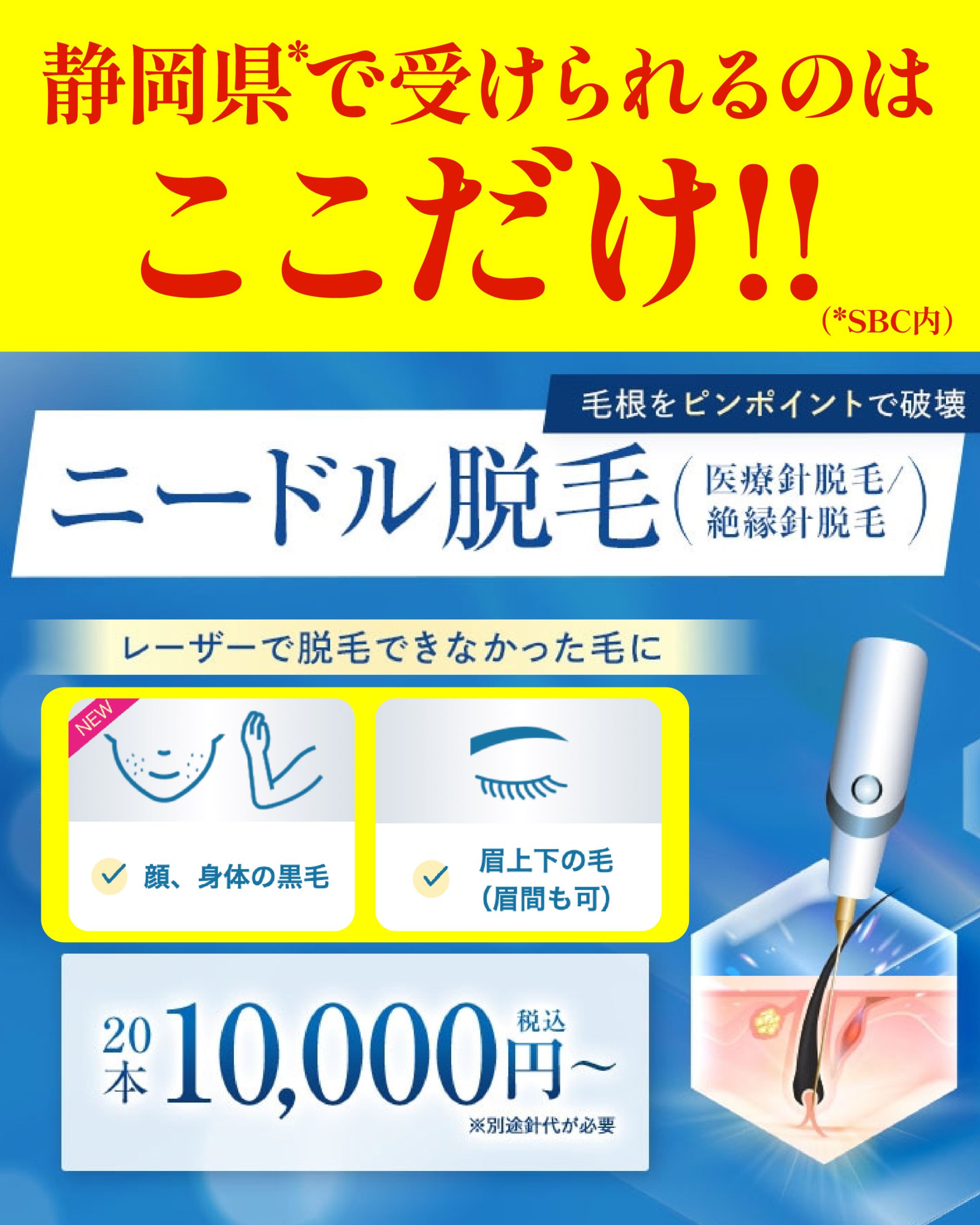 ＼新治療🆕／レーザーでは難しかった毛に✨ニードル脱毛