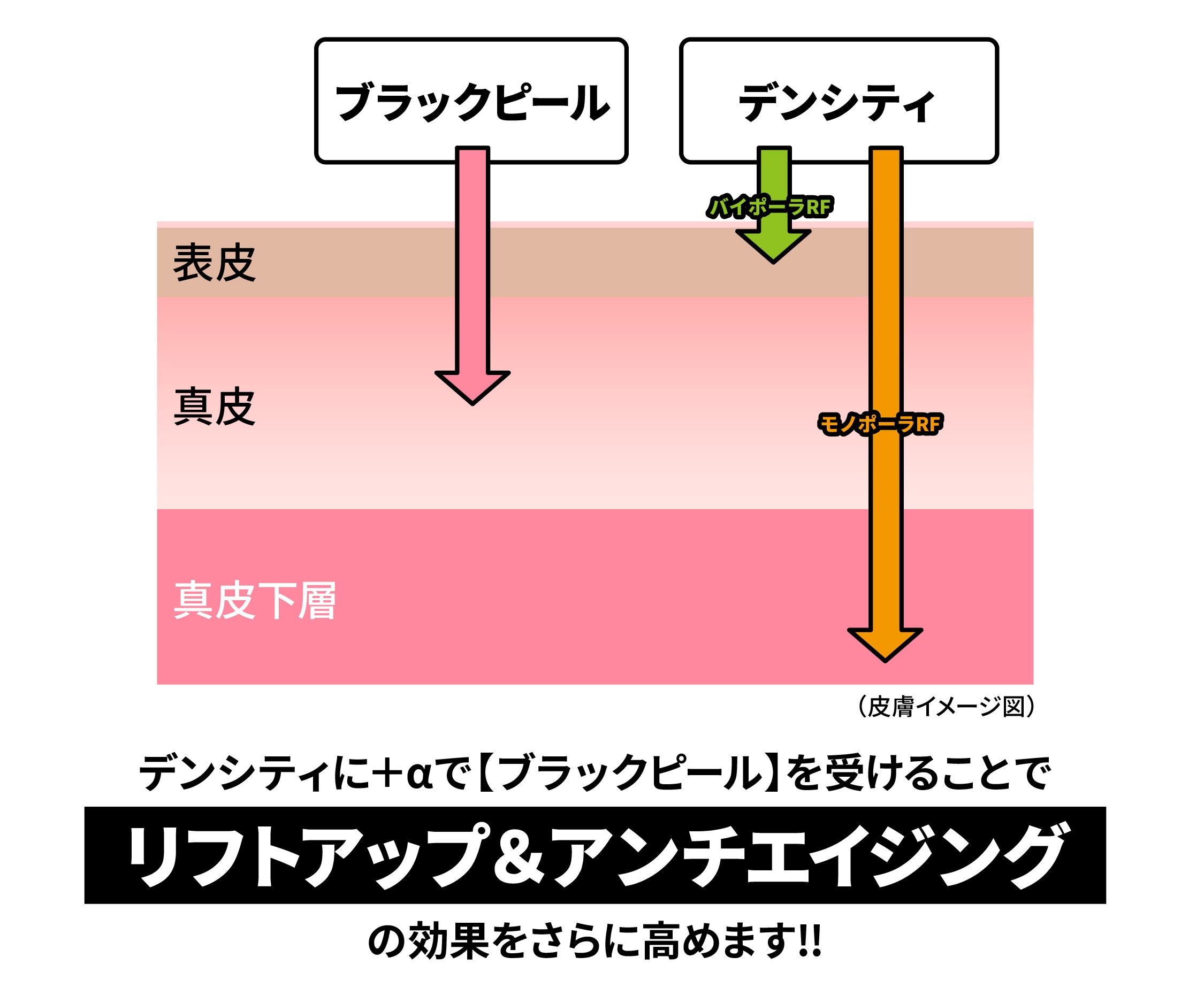 【ブラックピール×デンシティ】一緒に受けるメリットとは？