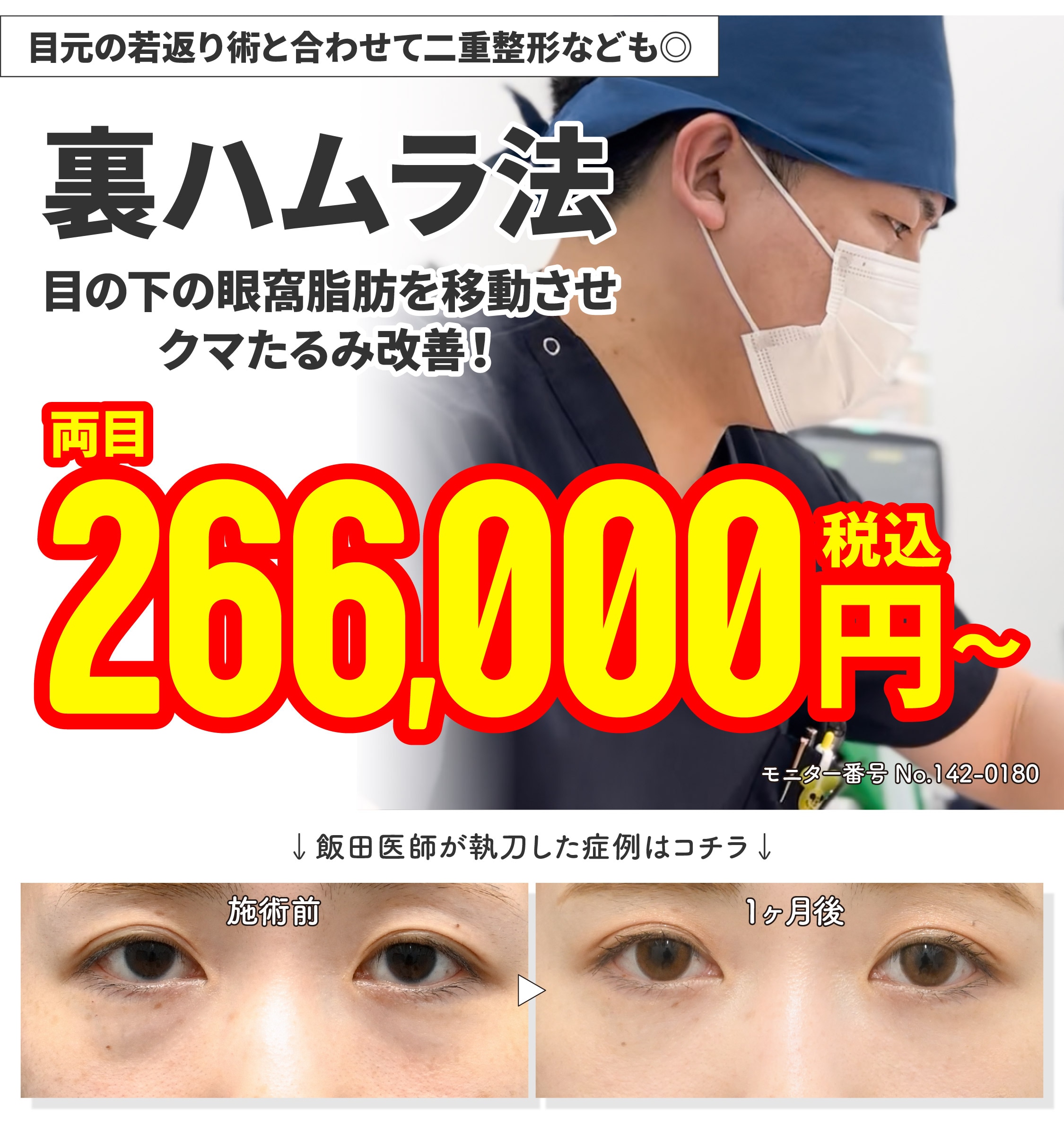【Dr.飯田執刀！モニター募集】②裏ハムラ法