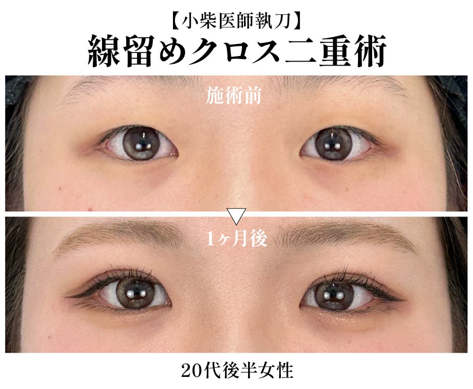 【小柴 優美医師】母性あふれるとても優しい先生で大人気✨静岡院在籍の女医