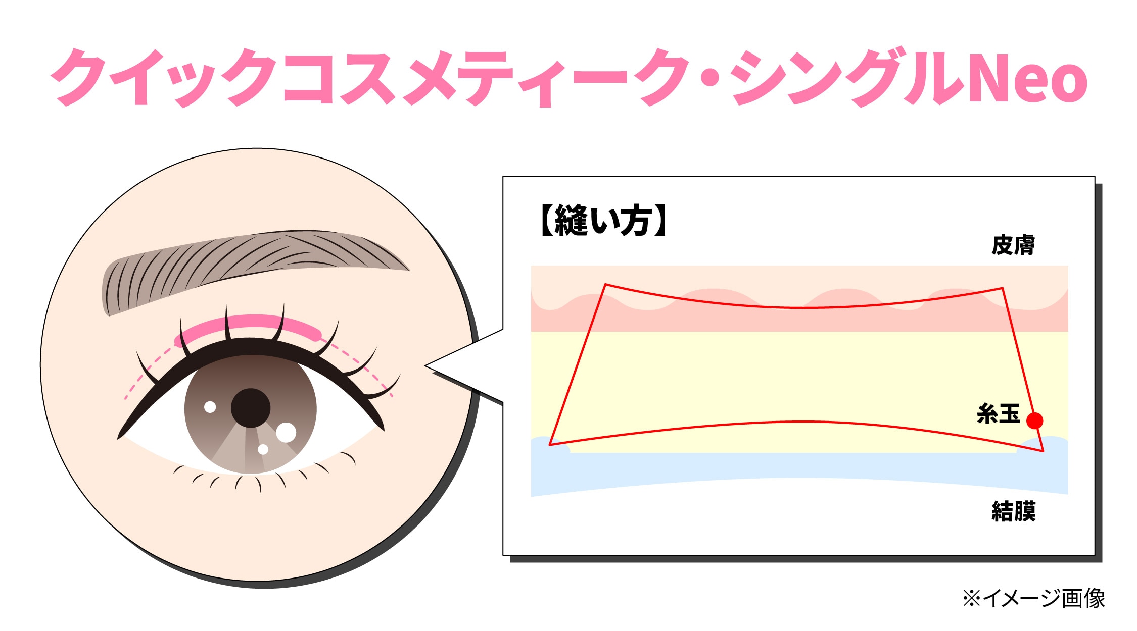 クイックコスメティーク・シングルNeo