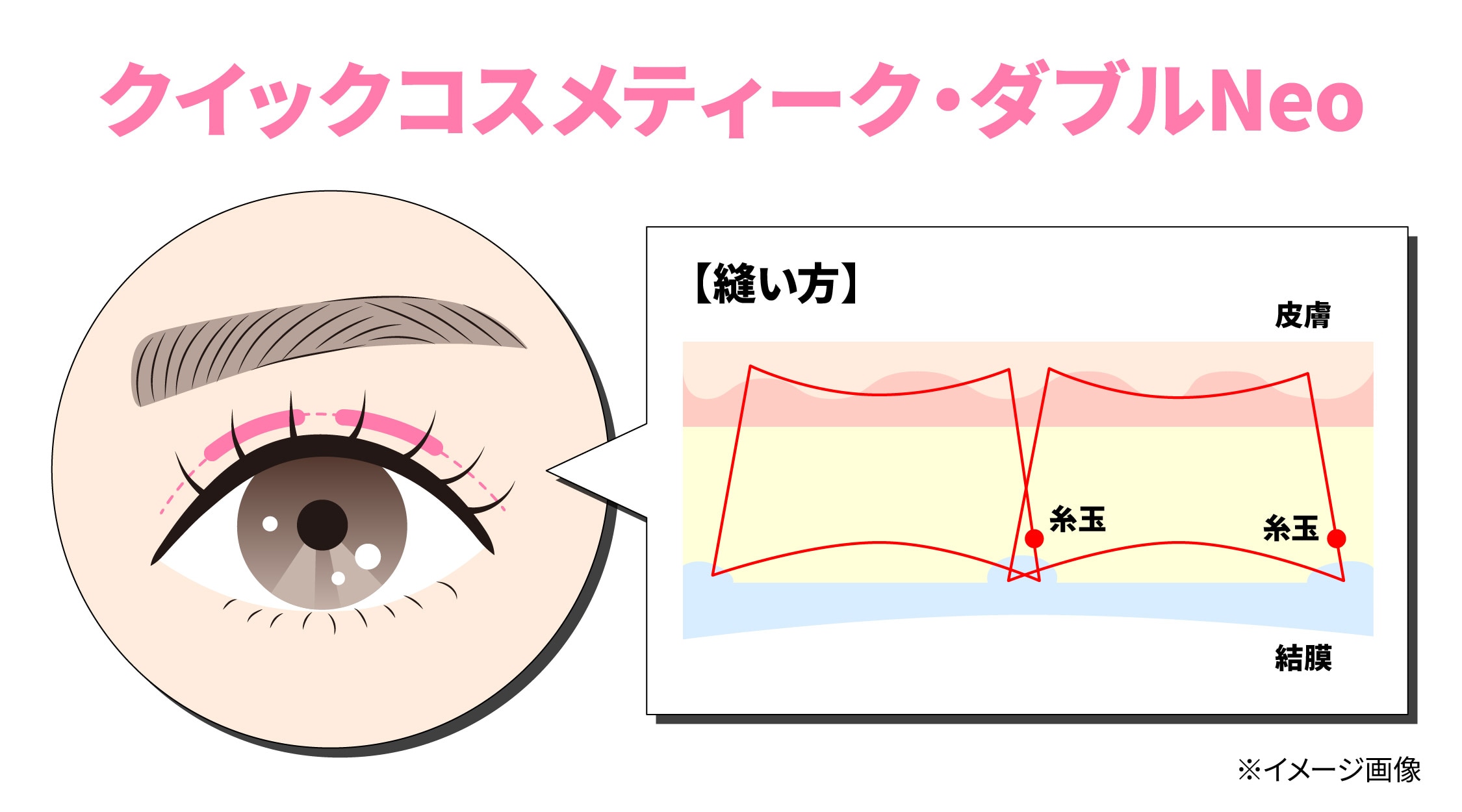クイックコスメティーク・ダブルNeo