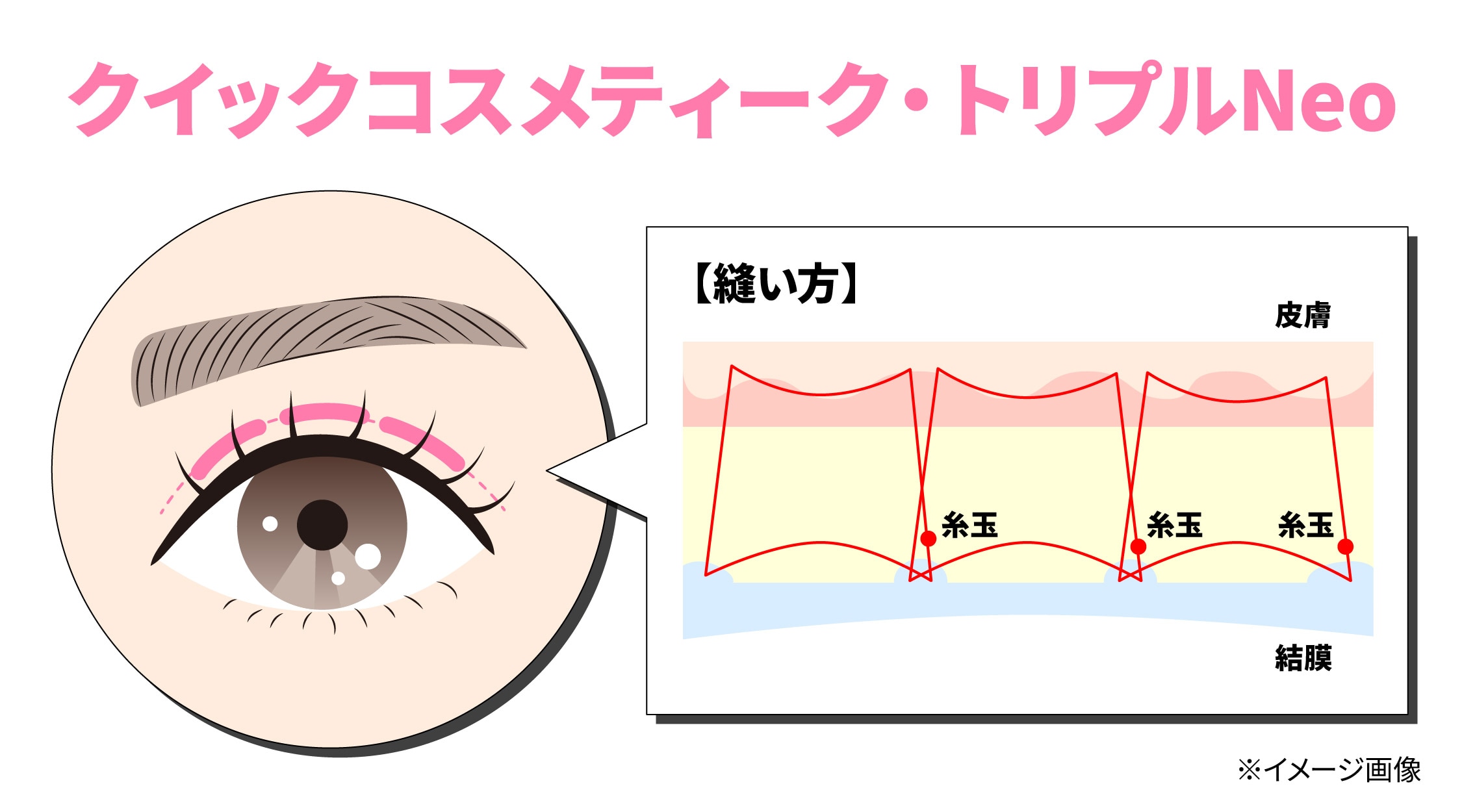 クイックコスメティーク・トリプルNeo