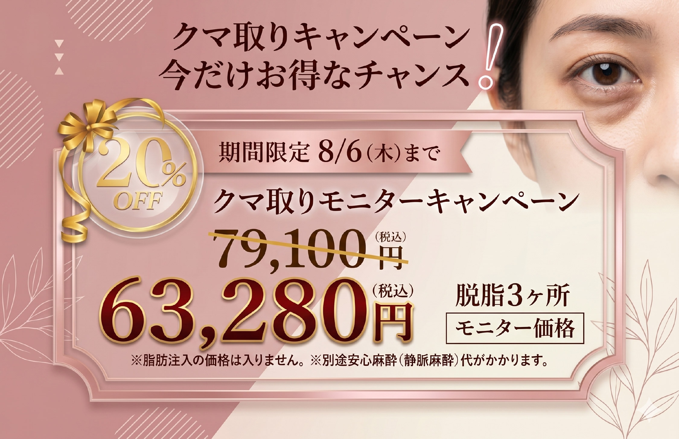 【8/6まで】クマ取りキャンペーン実施中🔥お得に受ける大チャンスです‼️