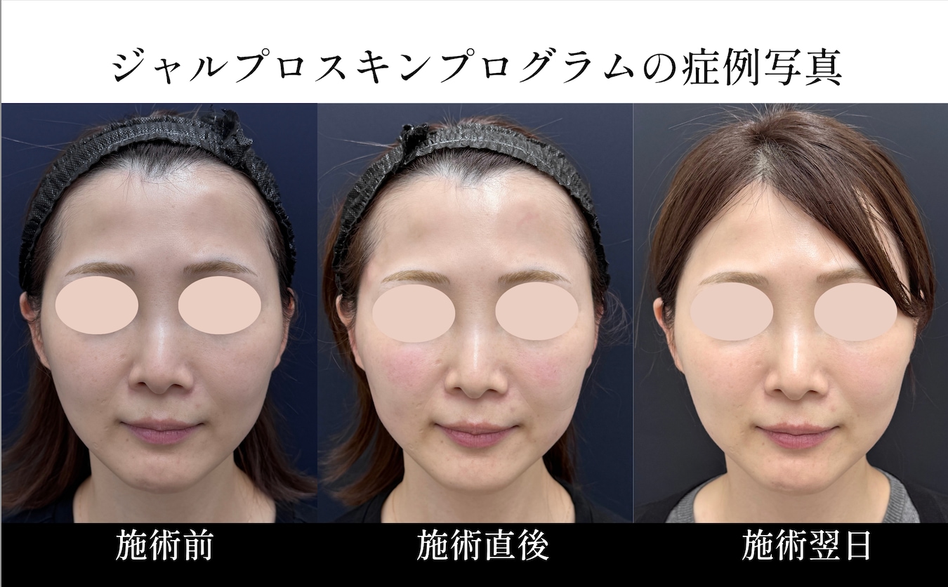 症例写真