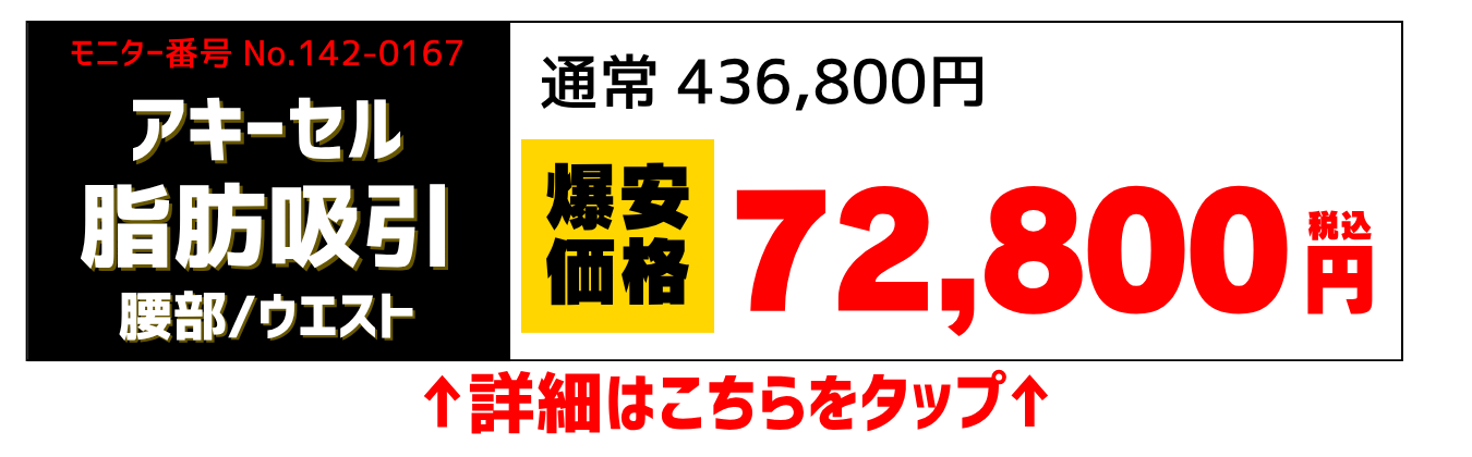 静岡院東大輝医師脂肪吸引モニター