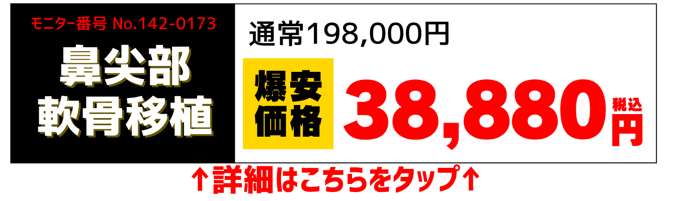 静岡院 東大輝医師鼻整形モニター