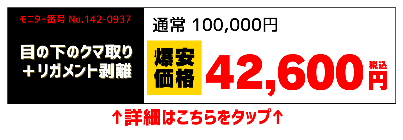 世永先生爆安　リガメント