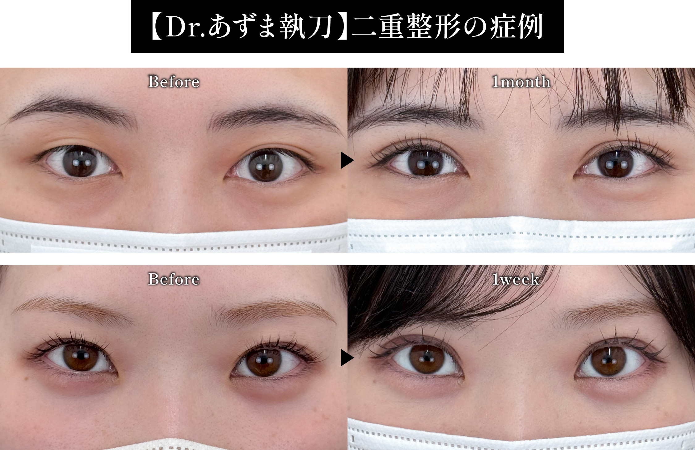 【9月限定】二重モニター募集✨