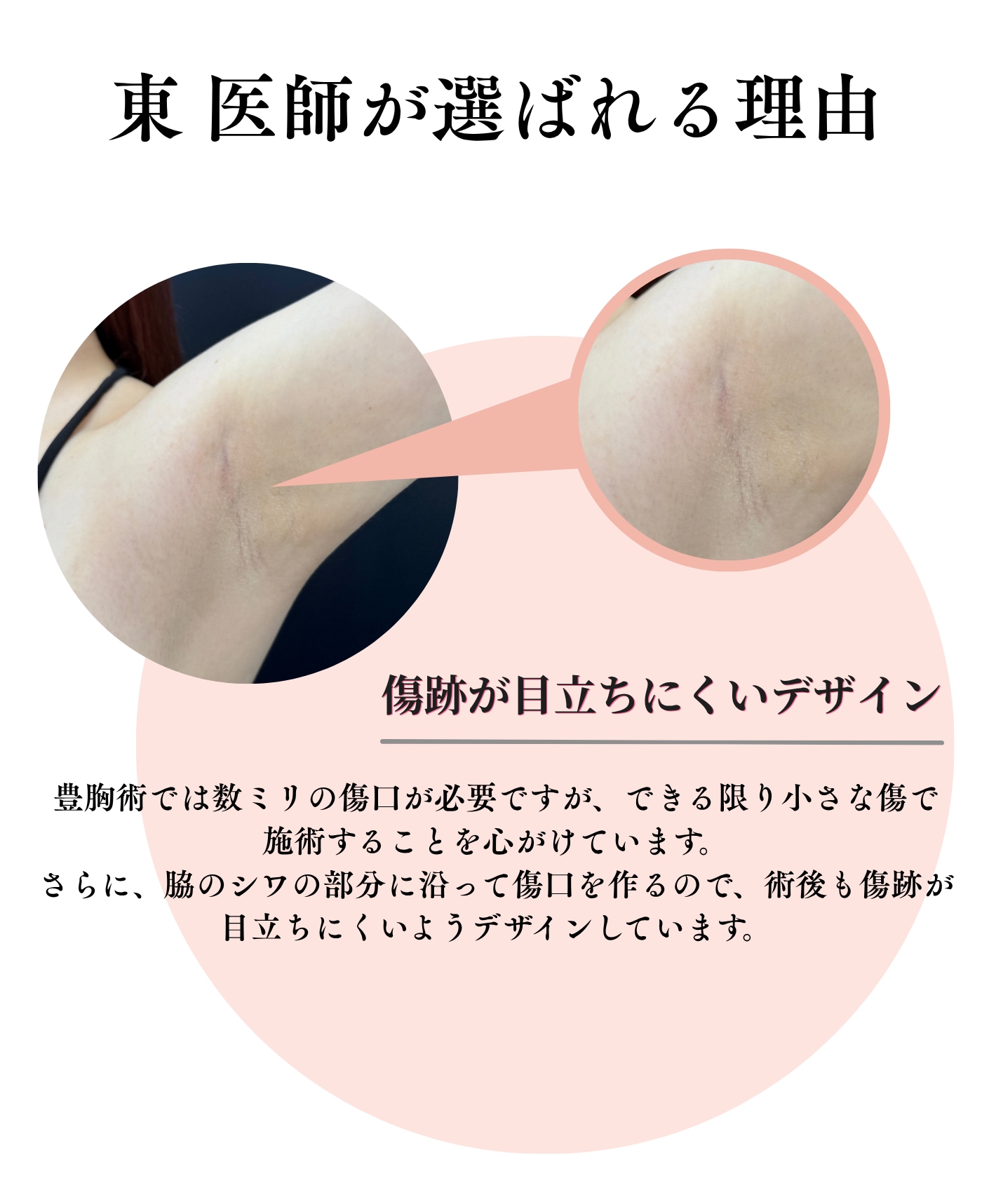 東先生の選ばれる理由