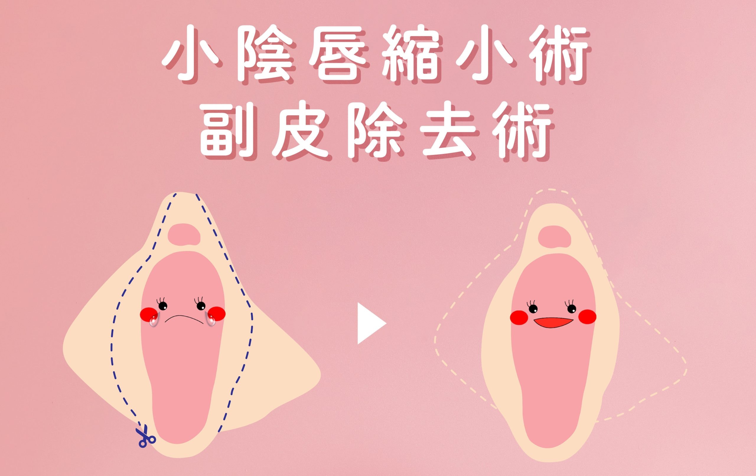 評判の良いプロバイダーを見つけるにはどうすればよいでしょうか?