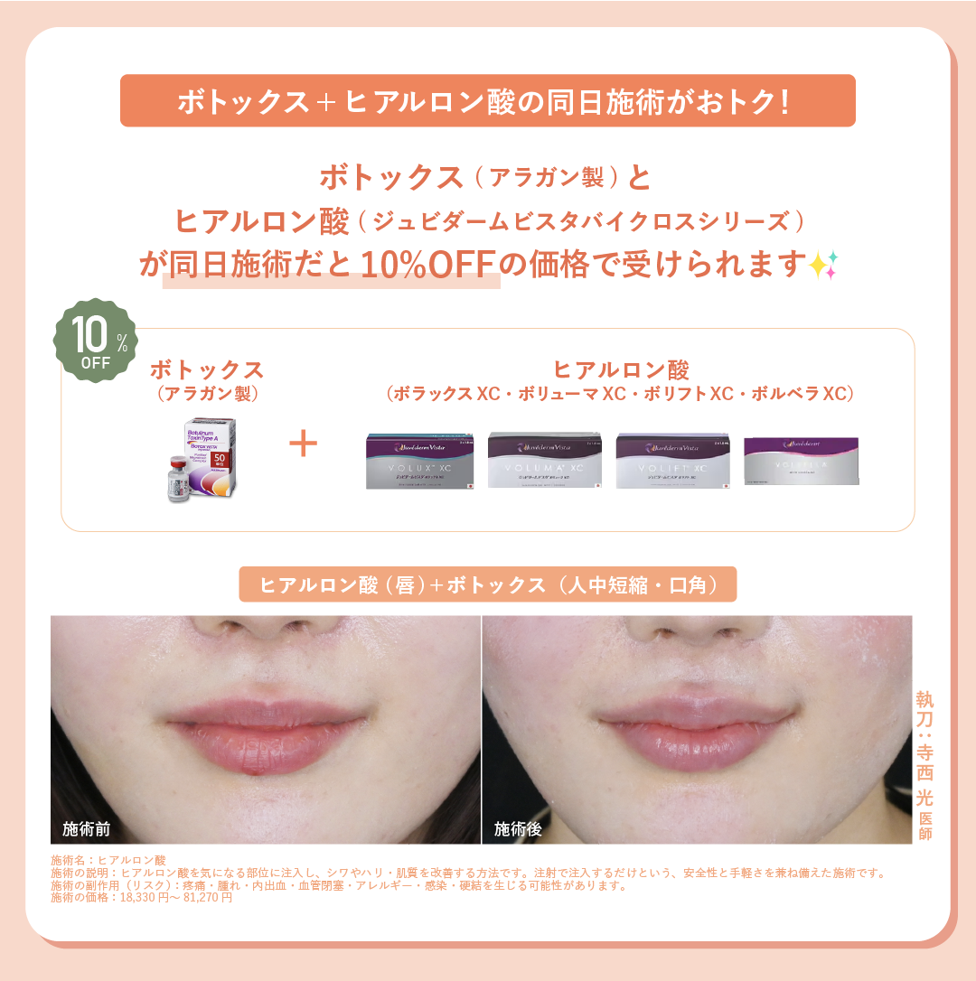 ボトックスとヒアルロン酸が同日施術で10%OFF!