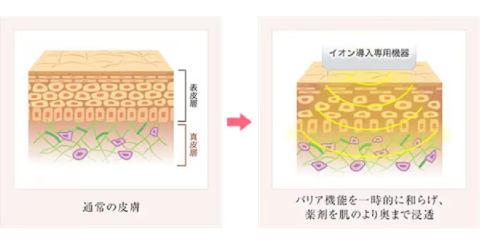 土台を整えた肌に「美肌成分」をダイレクトチャージ!