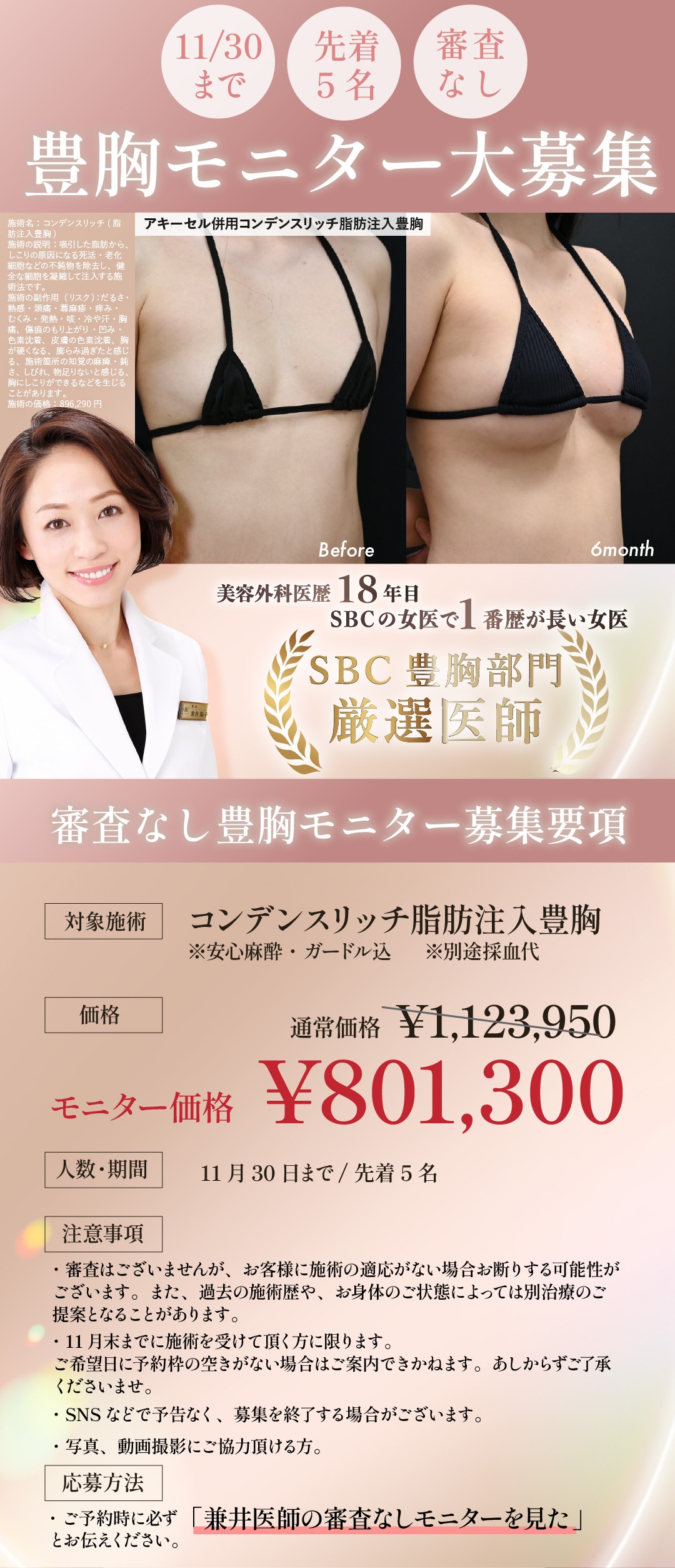 審査なし！豊胸モニター