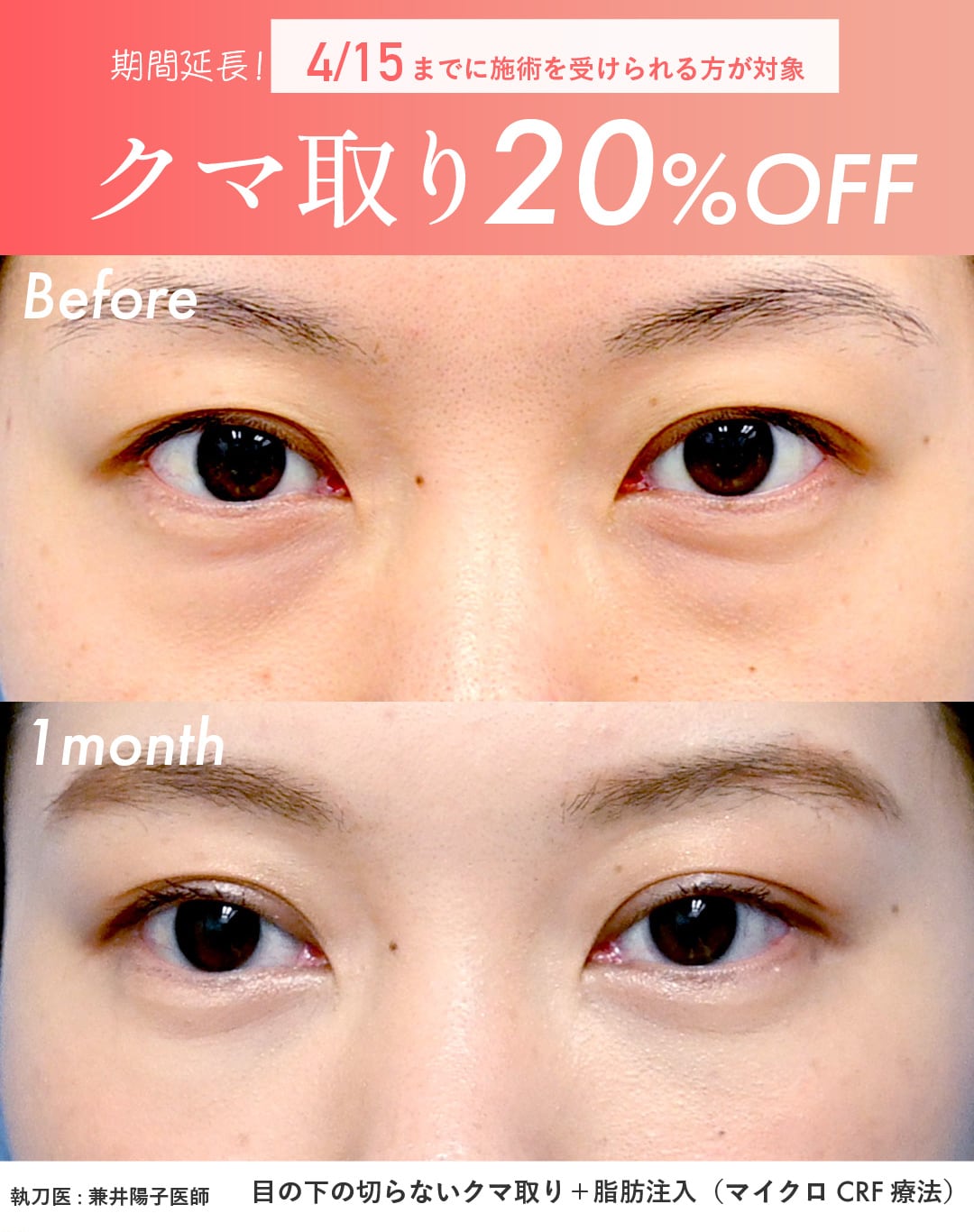 4/15までに受けられる方が対象！