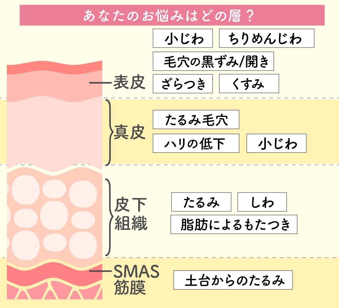 お悩みからみる狙うべき層