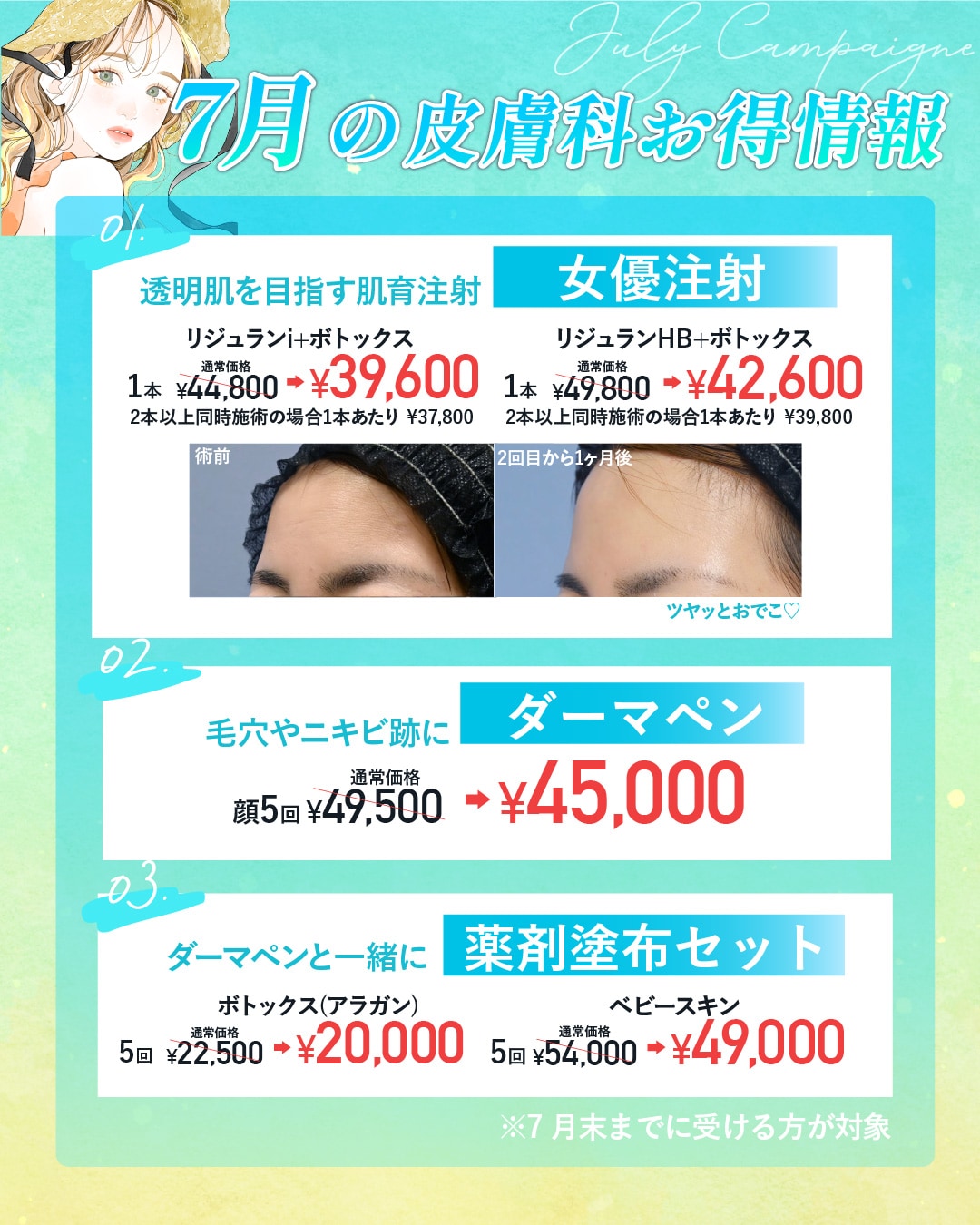 7月限定のお得な美容皮膚科施術✨