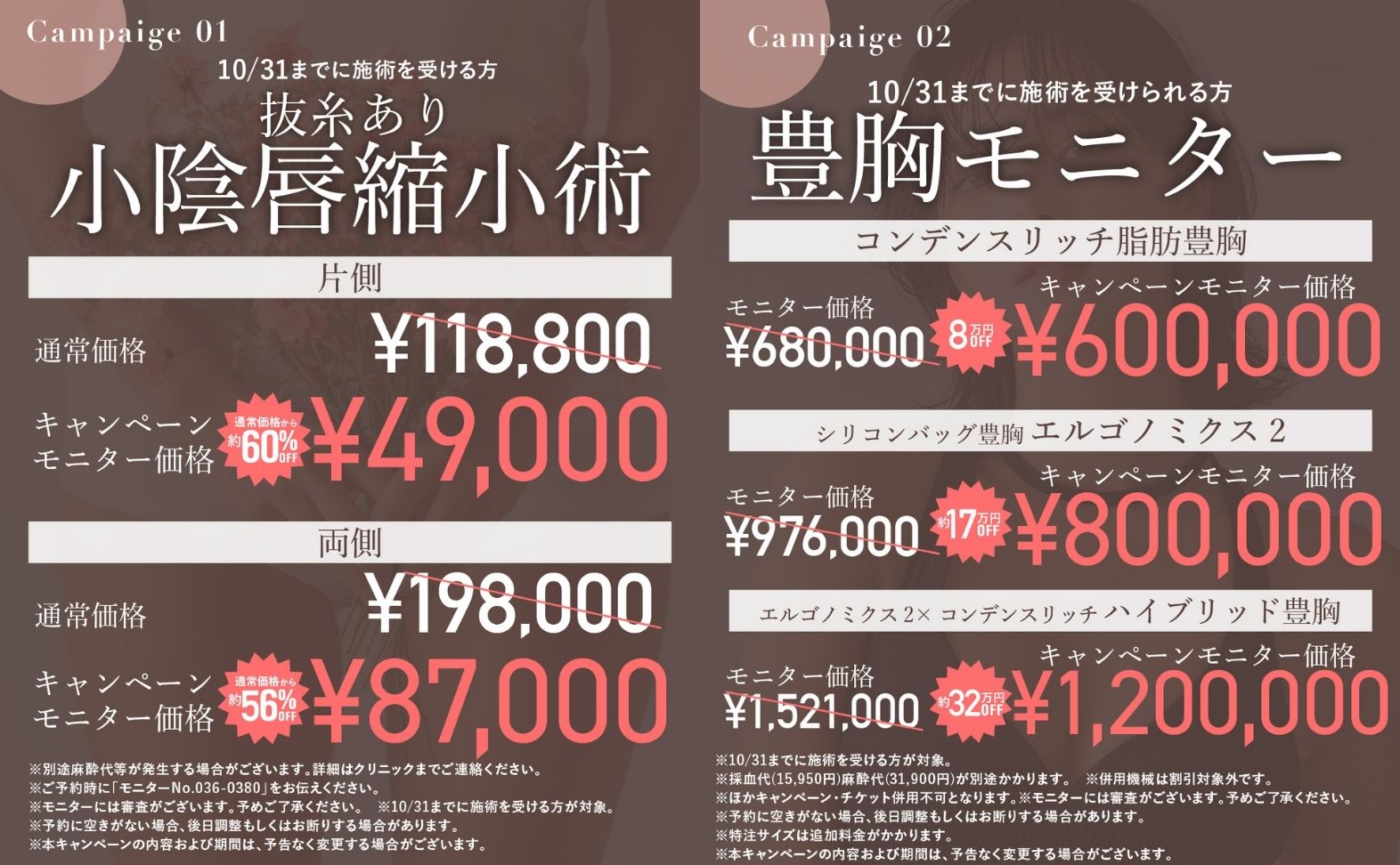 キャンペーン料金の詳細💰