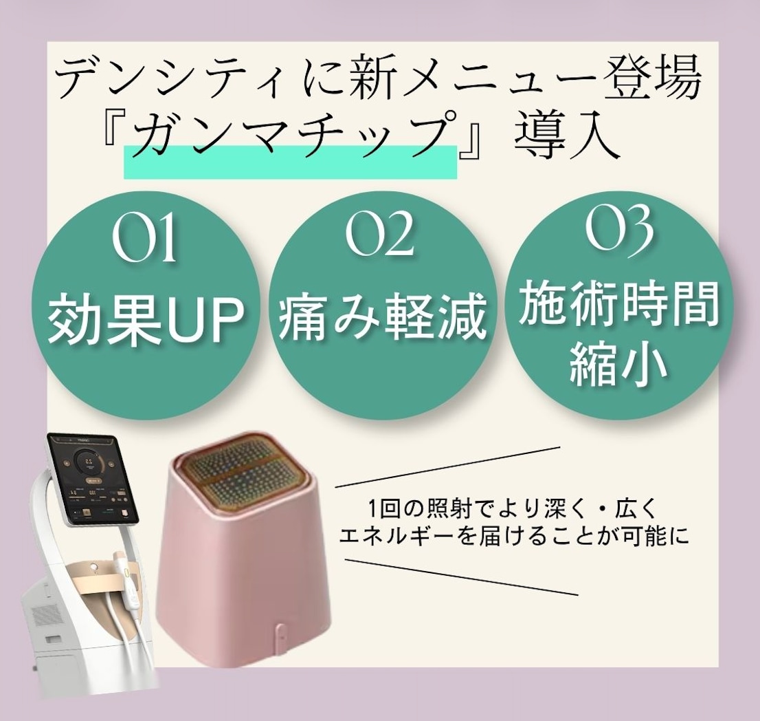 デンシティに新チップが登場しました🆕