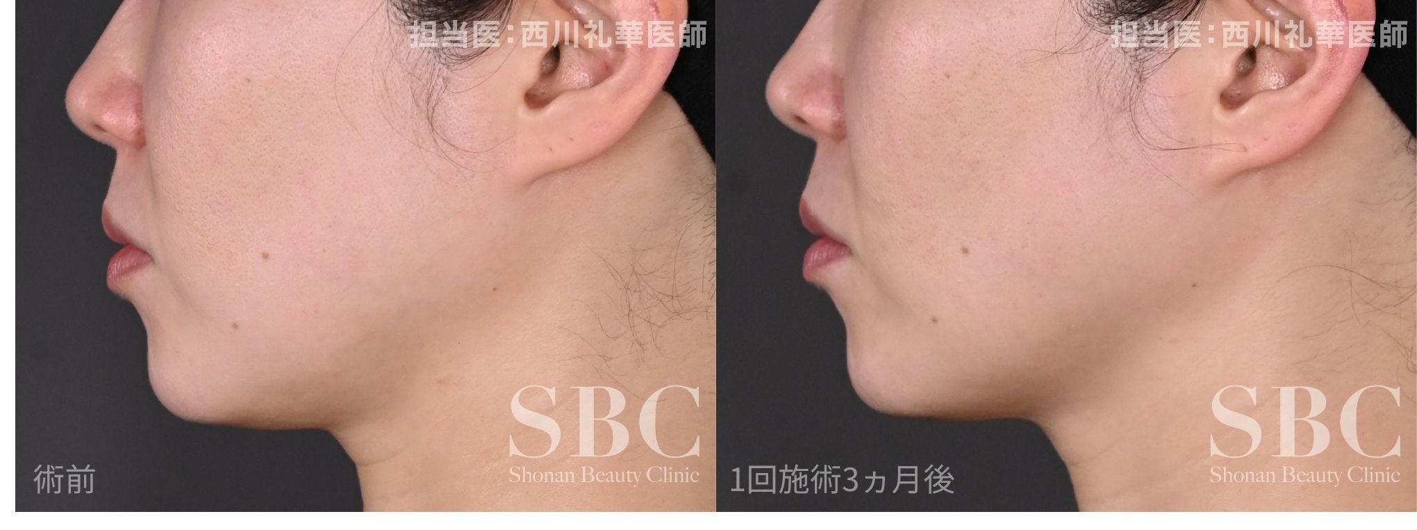 フェイスラインにご注目👀