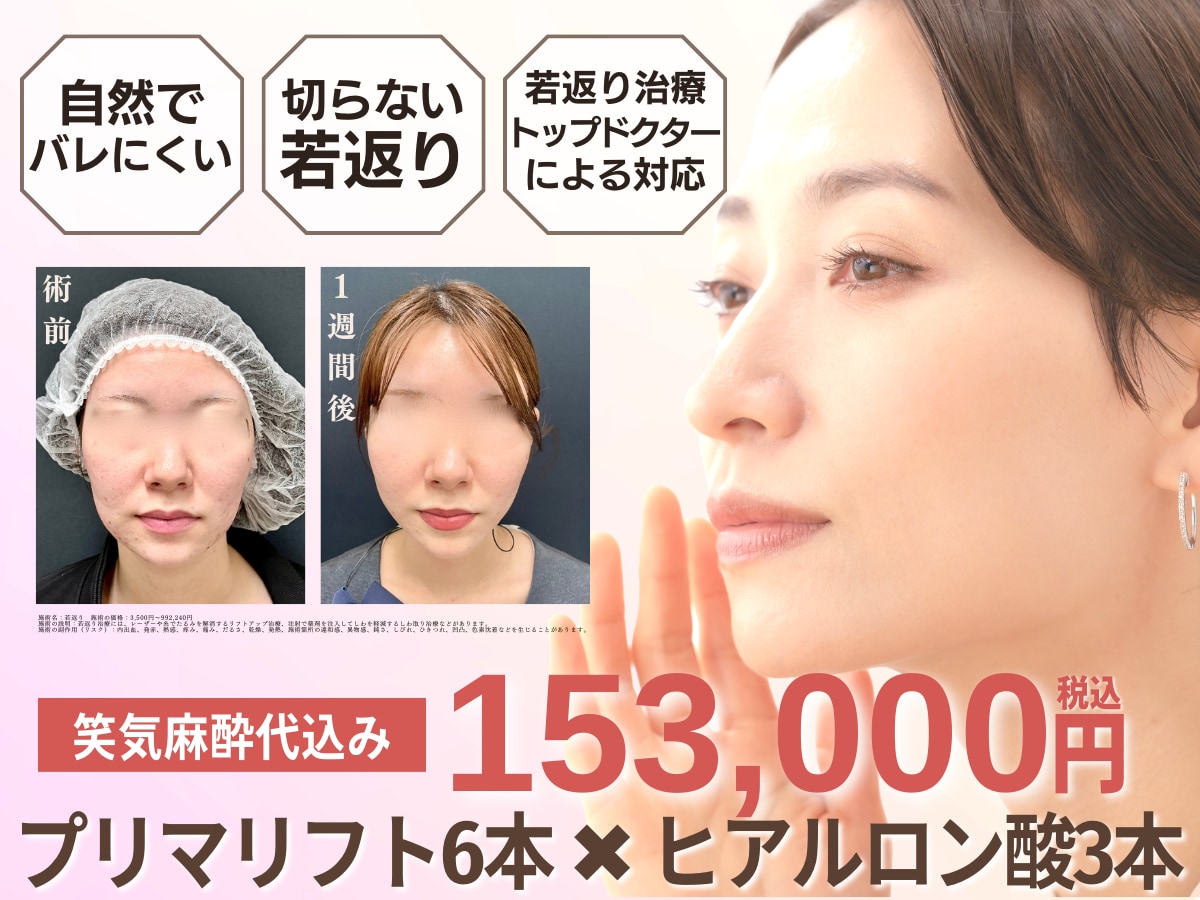 メスを使わず即日リフトUP！
