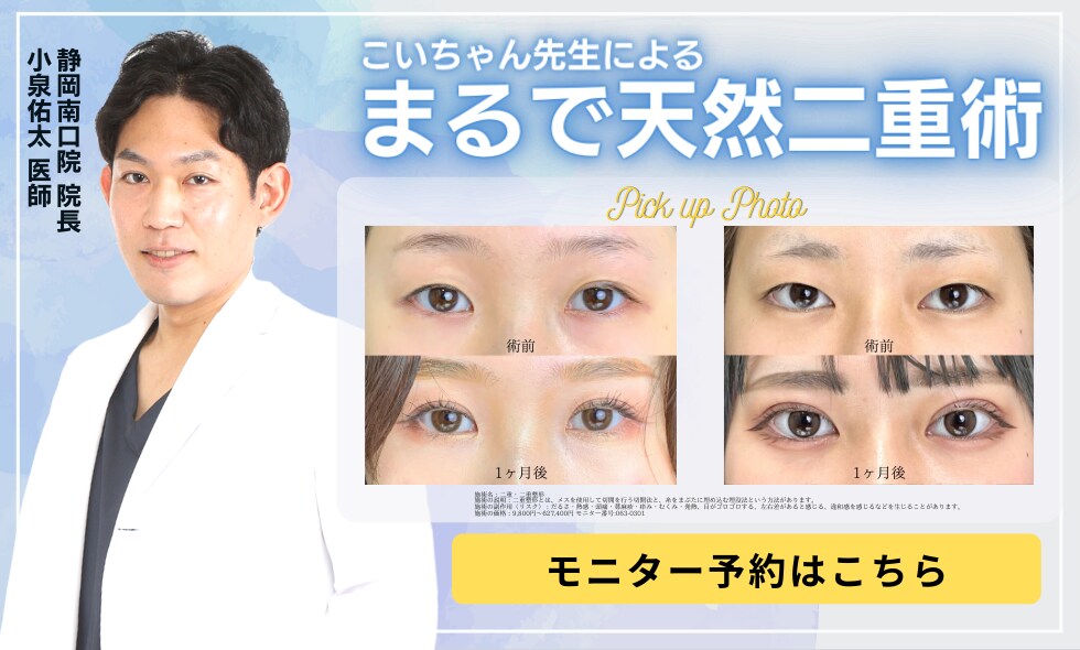 まるで天然二重のような目元になるならこいちゃん先生！