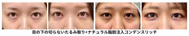 20代