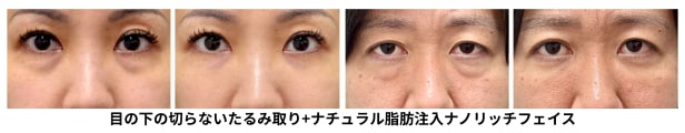 40代