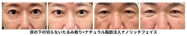 50代