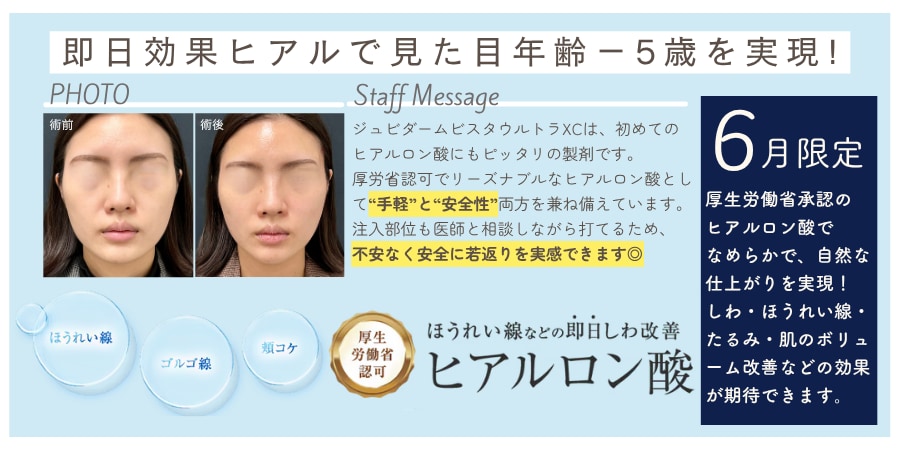 ヒアルロン酸が🉐大特価🉐