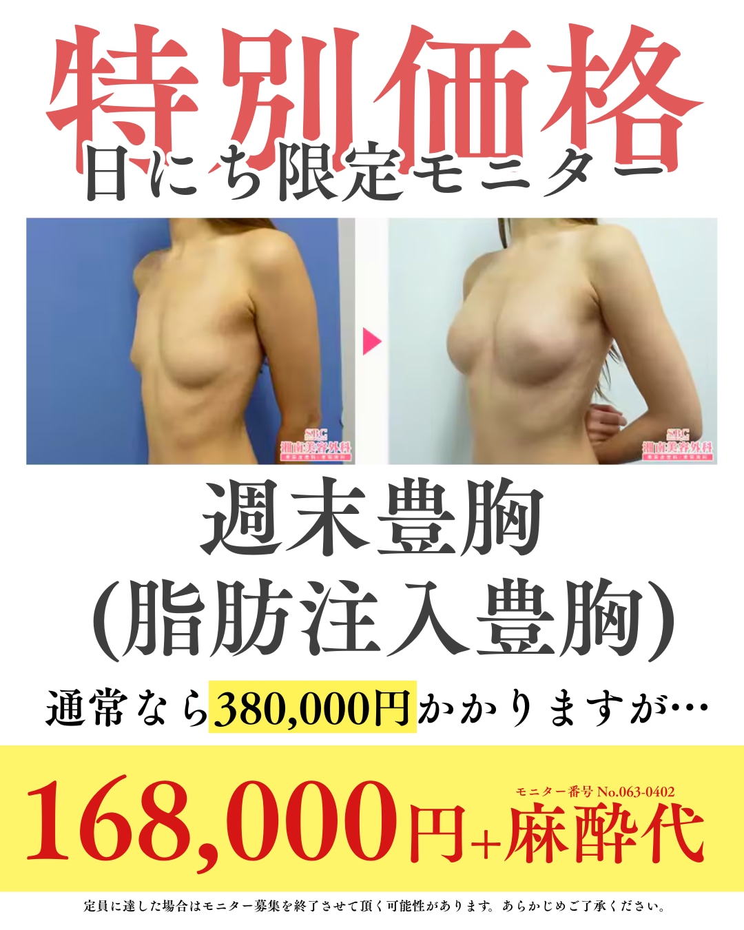 -事前診察必須お手術-