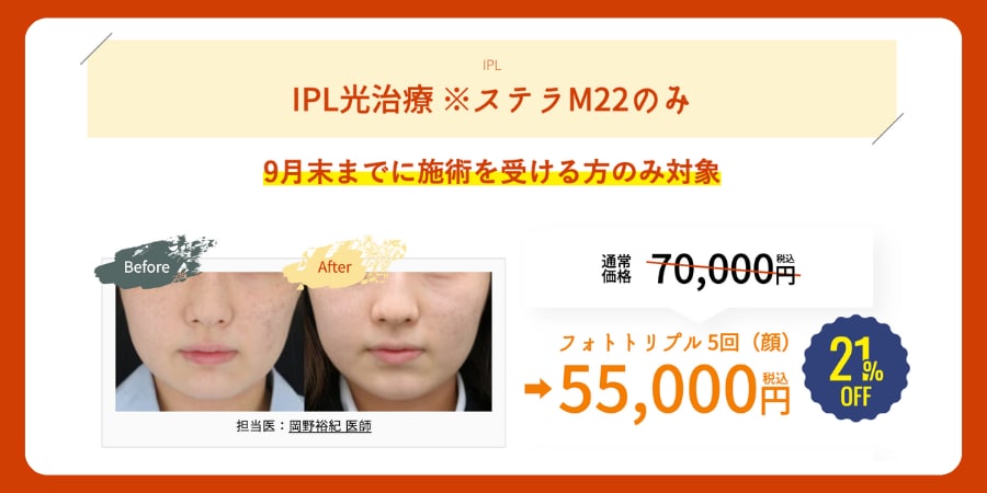 IPL光治療