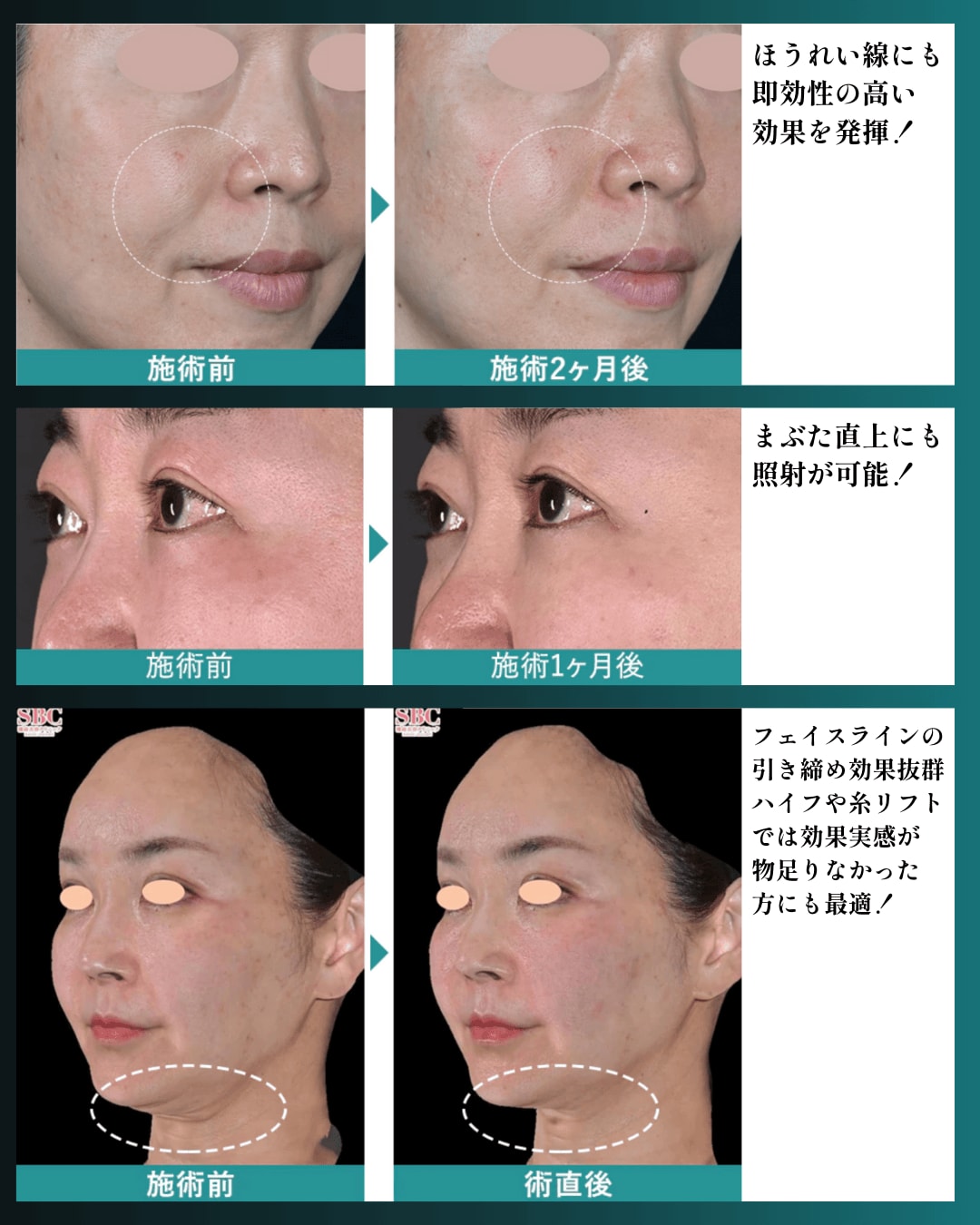 即効性で高評価