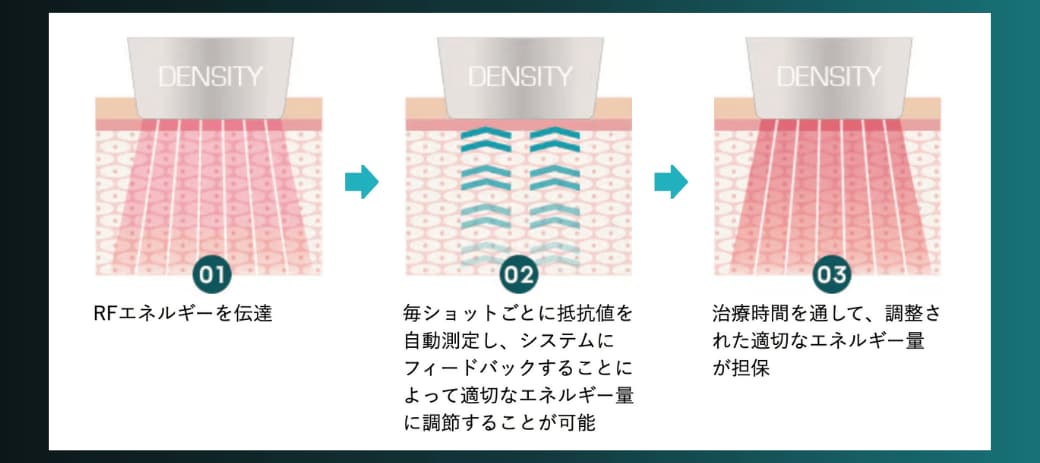 最新モノバイ技術