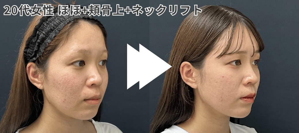 20代 女性