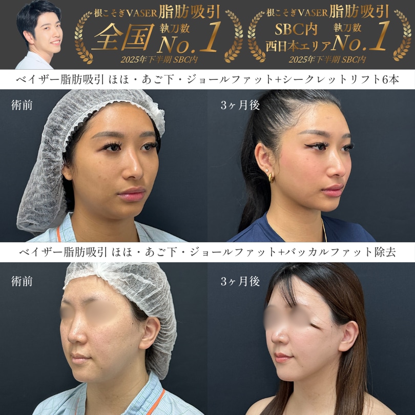 最も得意とする《小顔整形》