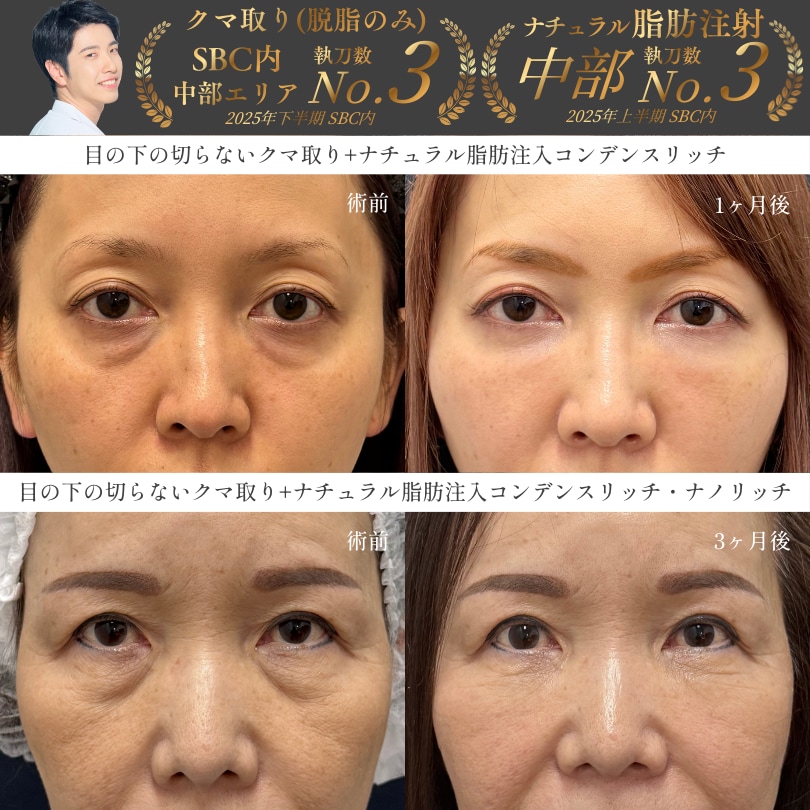 幅広い世代を執刀《クマ取り》