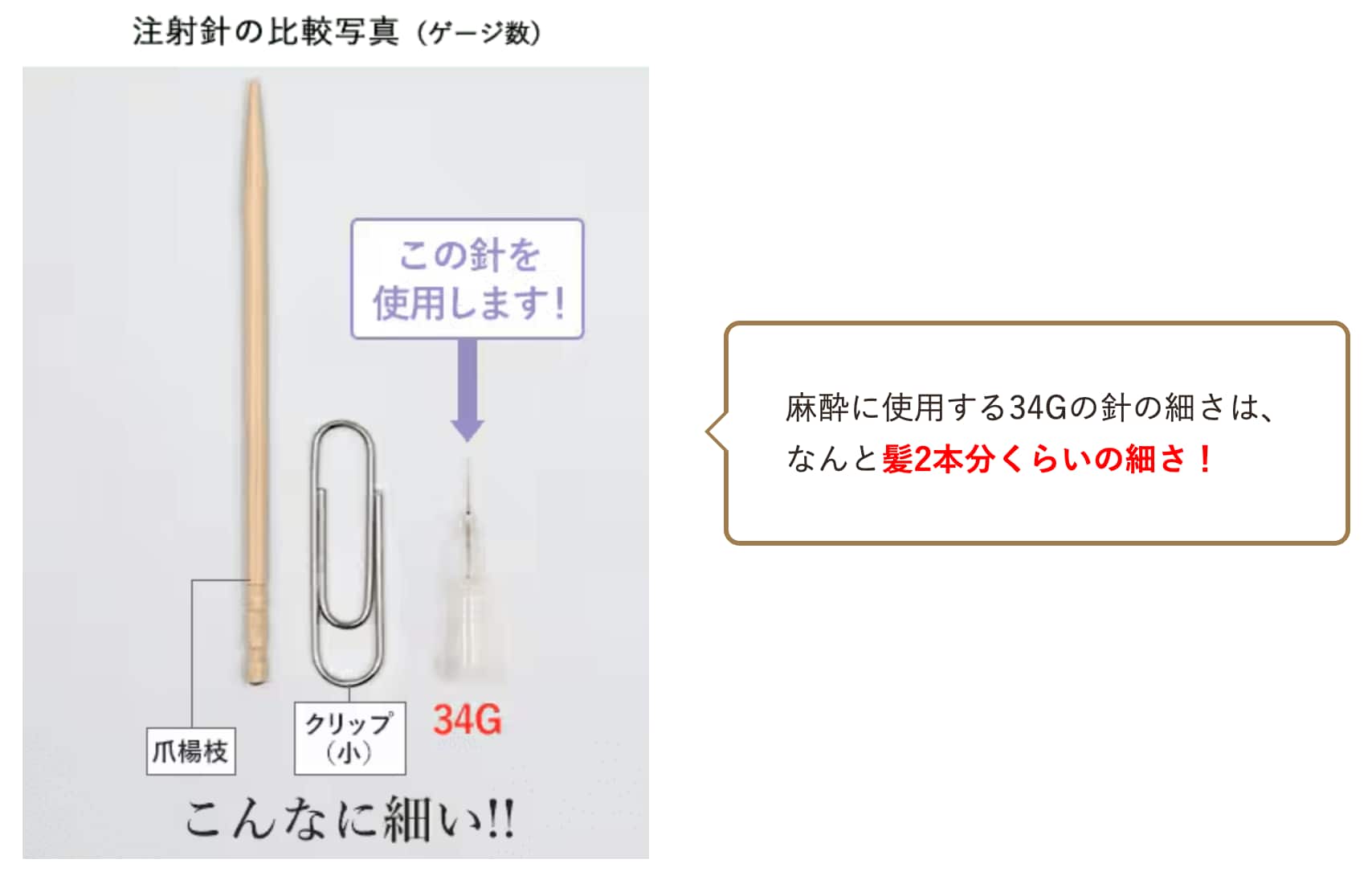 痛くないですか？<br />
手術中の痛みへの対策