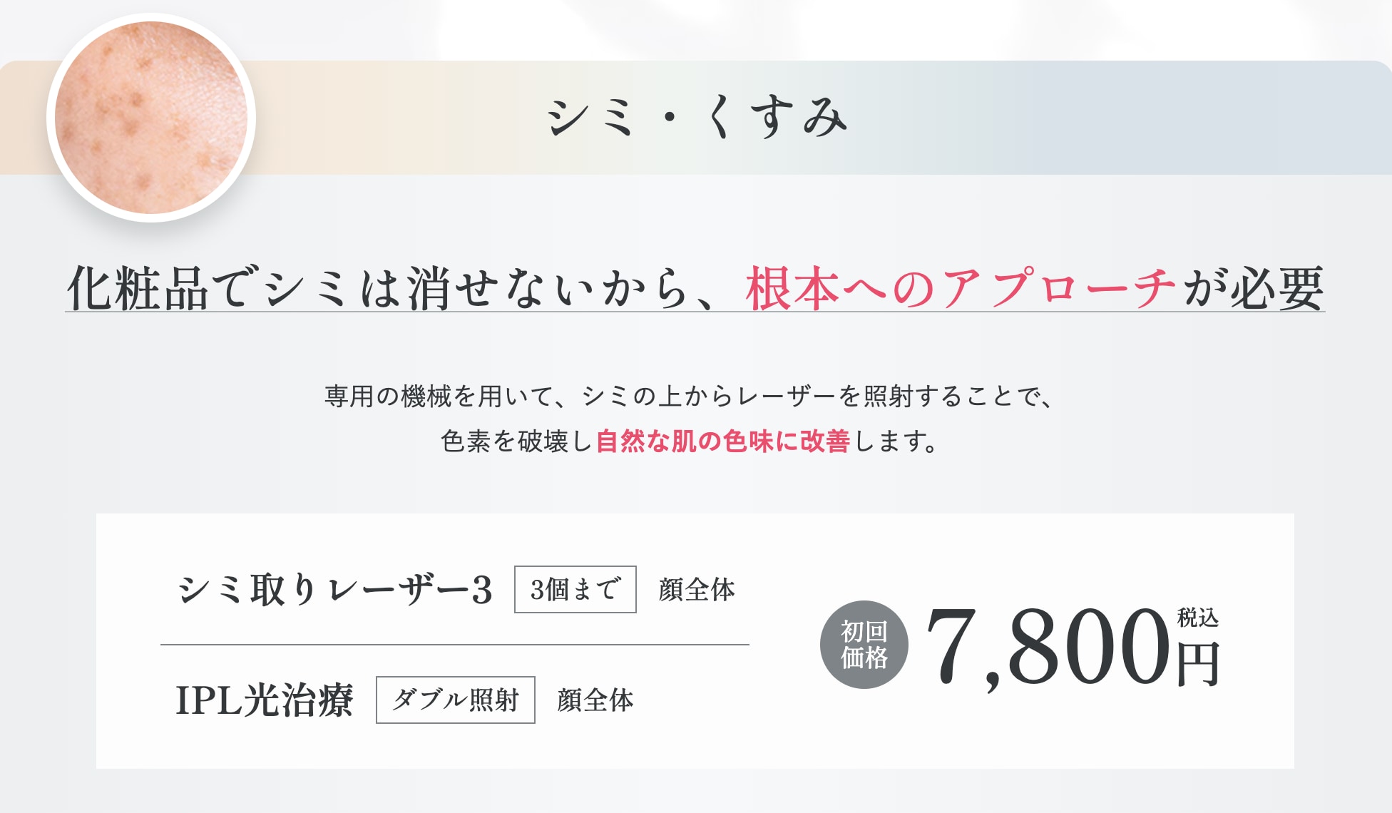 シミ・くすみが気になる方：シミ取りレーザー