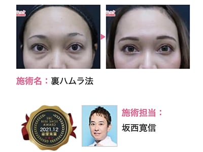症例数累積8000枚超!
