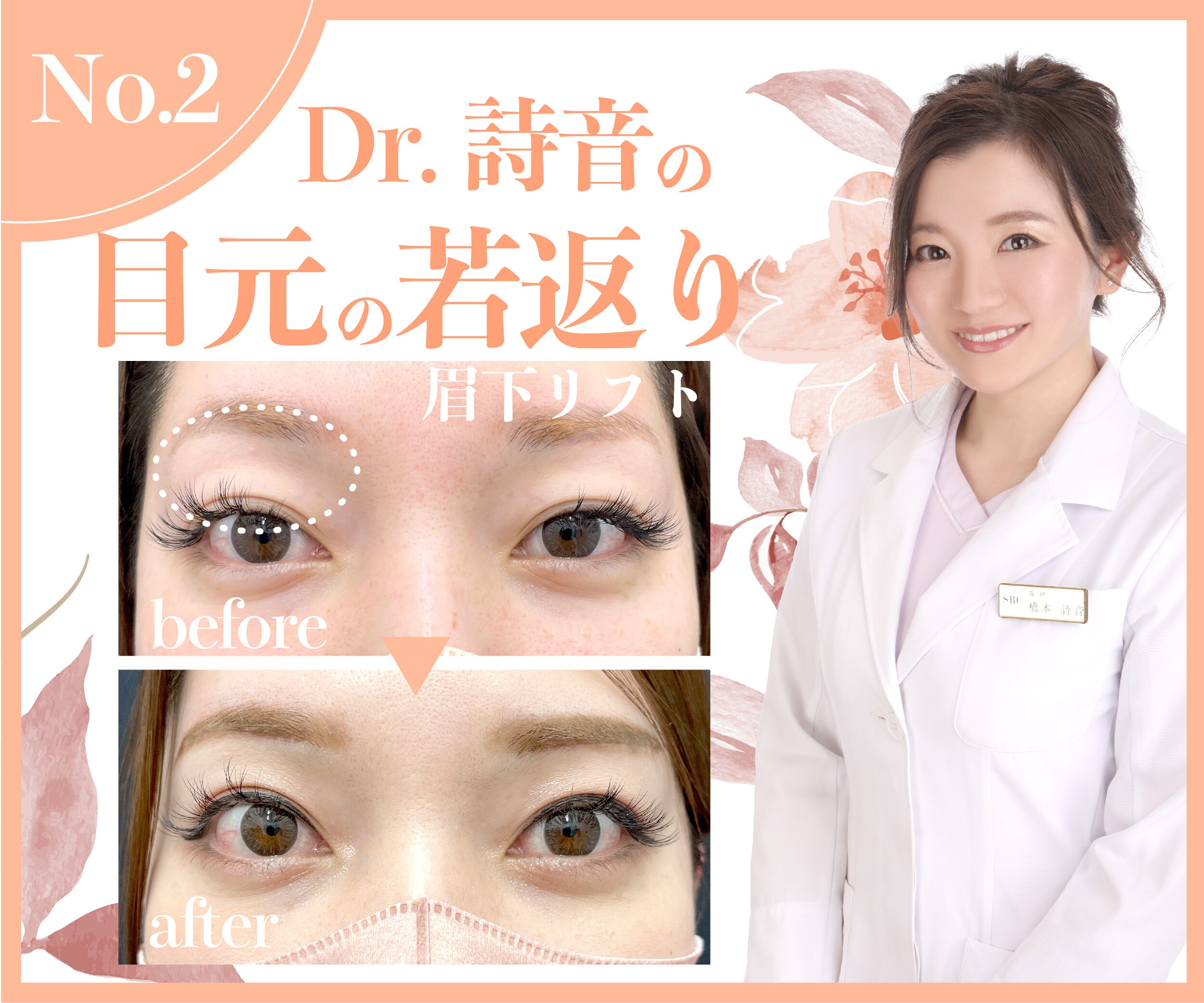 Dr.詩音の【目元の若返り】圧倒的に美しい仕上がりでスタッフ人気も絶大✨
