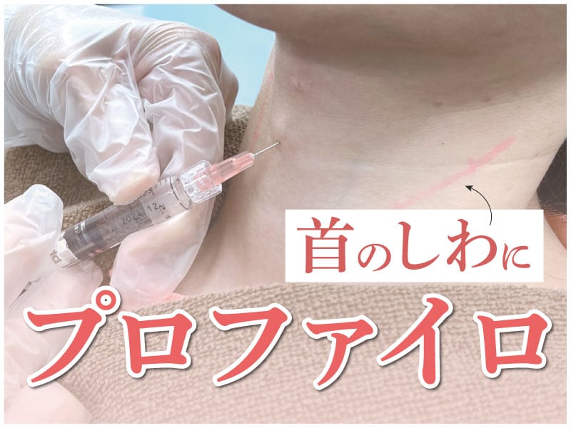 首のシワ対策には「プロファイロ」がおすすめ！その理由とは？ - 新宿 
