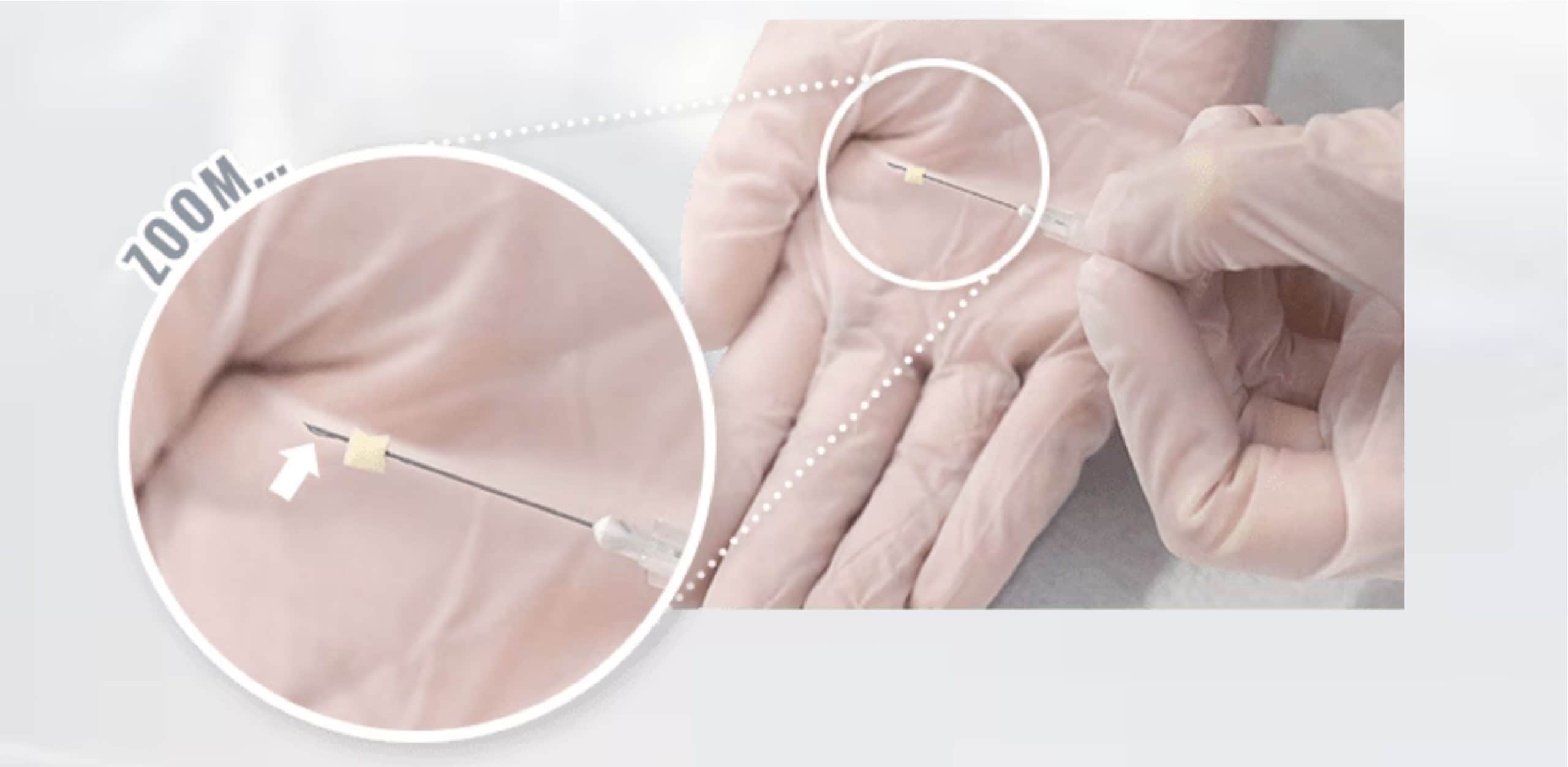 トキシルって？？