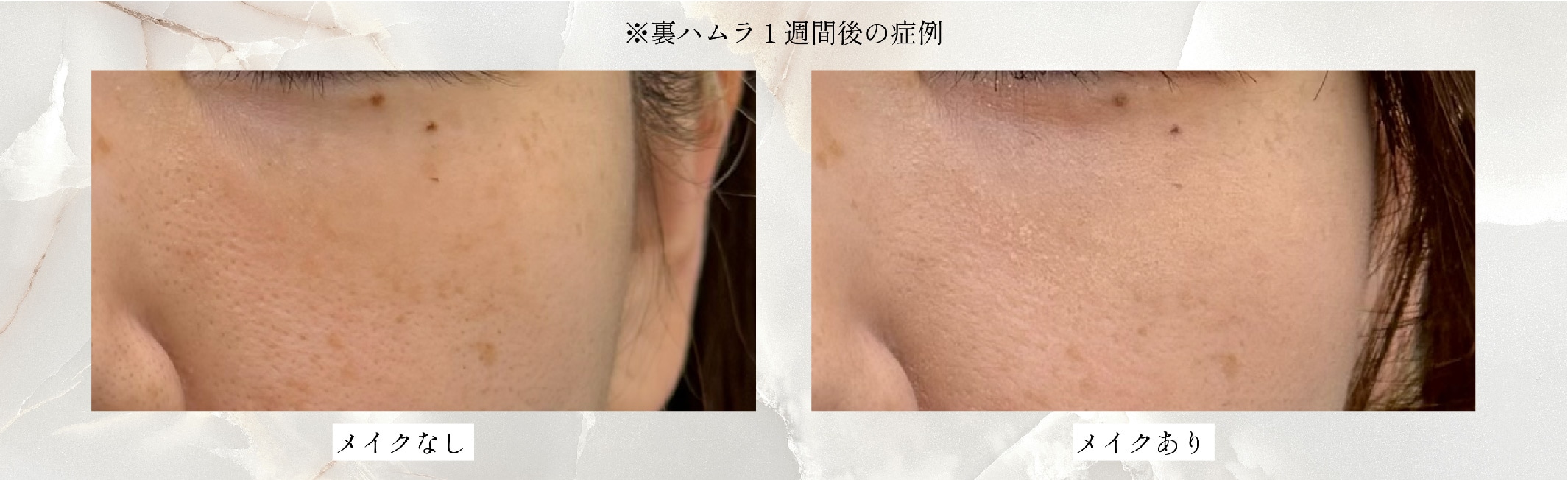 メイクで隠せる！！