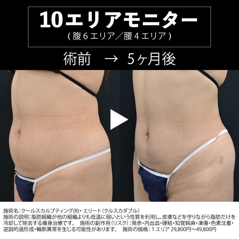 10エリアモニター