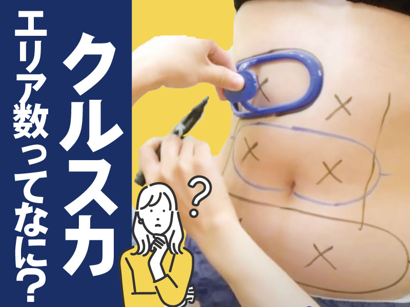 「何エリア必要？」クルスカの部位別デザインガイド【SBC新宿南口院】